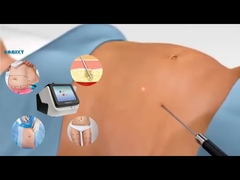 Лазерное оборудование для похудения 30 Вт 60 Вт 980 нм Диодный лазерный липомашина для похудения